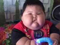 Bayi 16 Bulan di Bekasi Viral dengan Bobot 27 Kg, Dirujuk ke RSCM untuk Pemeriksaan Lanjutan